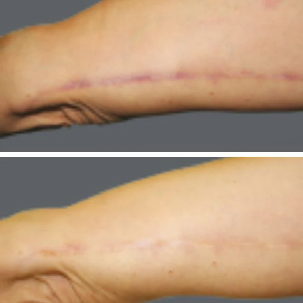 Sabine F. Vorher/Nachher